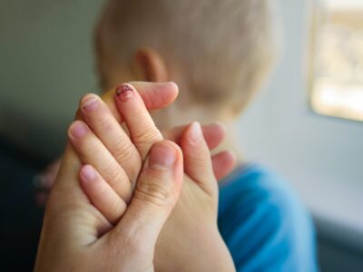 Nagelbettentzündung: Entzündung am Zeh beim Kind