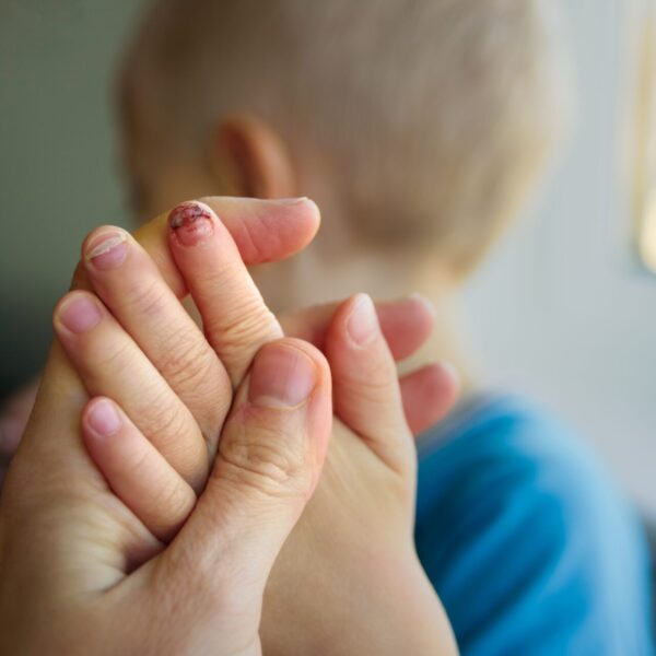 Wie viel sollte man mit 13 wiegen? Normales Gewicht Kinder